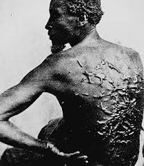 Photograph of a slave with scars from being whipped